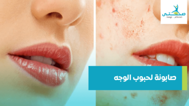 صابونة لحبوب الوجه