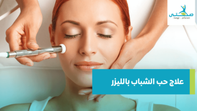 علاج حب الشباب بالليزر