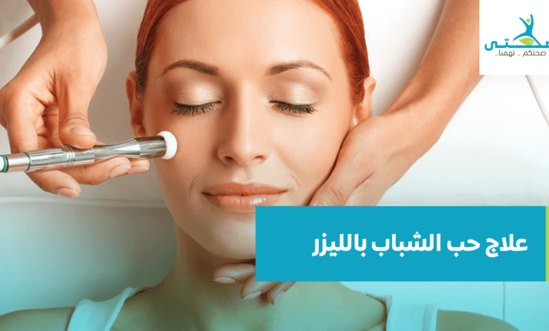 علاج حب الشباب بالليزر