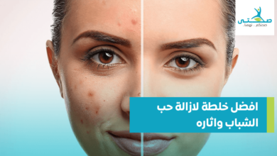 افضل خلطة لازالة حب الشباب واثاره