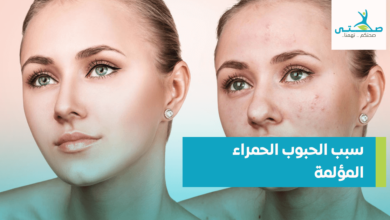 سبب الحبوب الحمراء المؤلمة