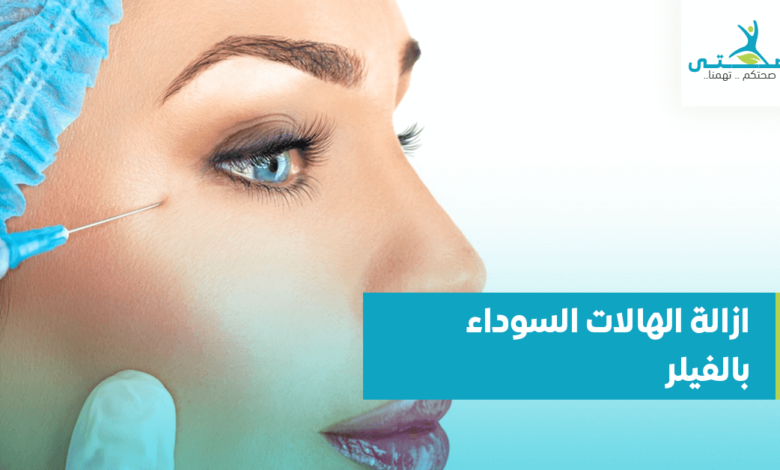 علاج الهالات السوداء بالفيلر
