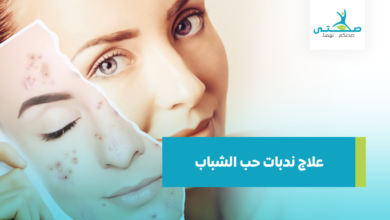 علاج ندبات حب الشباب