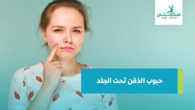 حبوب الذقن تحت الجلد