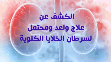 علاج واعد ومحتمل لسرطان الخلايا الكلوية