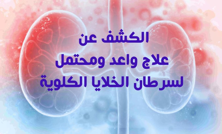 علاج واعد ومحتمل لسرطان الخلايا الكلوية