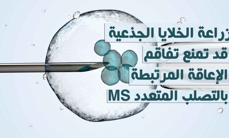 زراعة الخلايا الجذعية قد تمنع تفاقم الإعاقة المرتبطة بالتصلب المتعدد MS