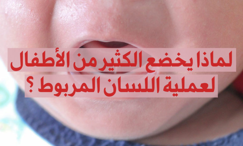 الأطفال وعملية اللسان المربوط