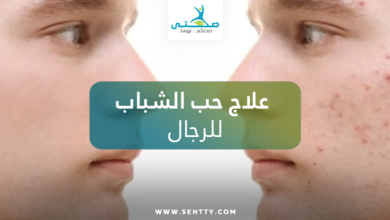 علاج حب الشباب للرجال