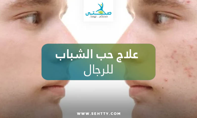 علاج حب الشباب للرجال