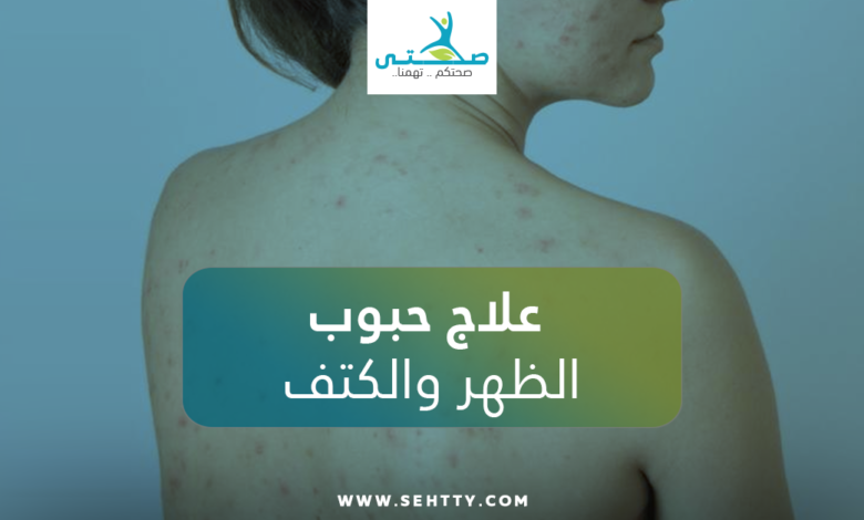 علاج حبوب الظهر والكتف