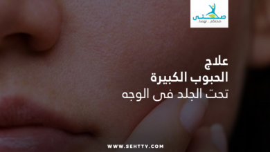 علاج الحبوب الكبيرة تحت الجلد في الوجه
