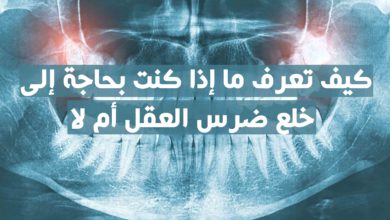 خلع ضرس العقل