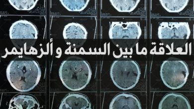 العلاقة ما بين السمنة و ألزهايمر