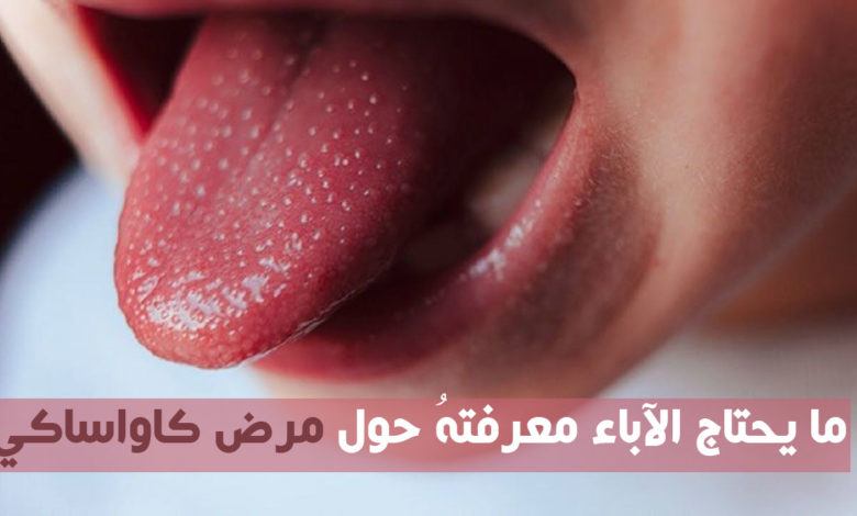 ما يجب على الآباء معرفته عن مرض كاواساكي