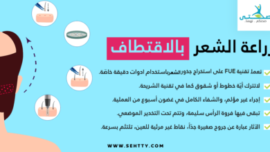 زراعة الشعر بالاقتطاف