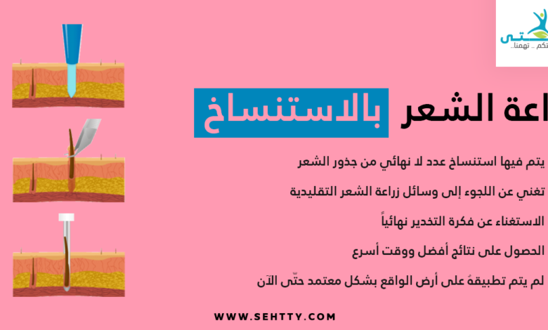 زراعة الشعر بالاستنساخ