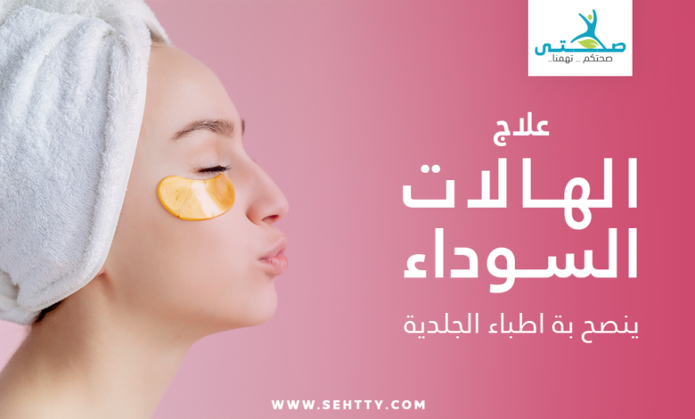 الهالات السوداء