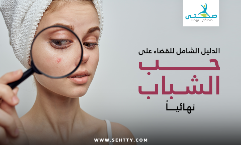 حب الشباب