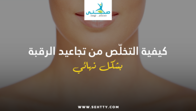 تجاعيد الرقبة