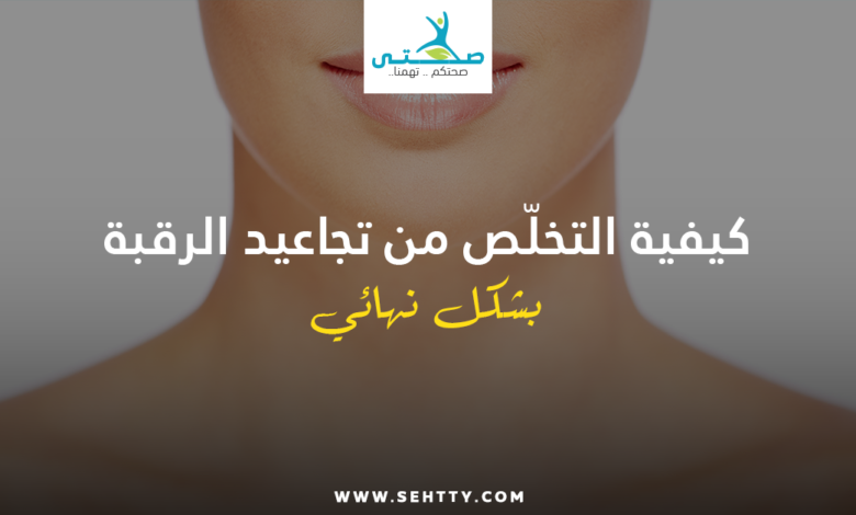 تجاعيد الرقبة