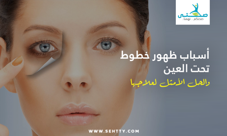 أسباب وطرق علاج خطوط تحت العين