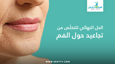 تجاعيد حول الفم
