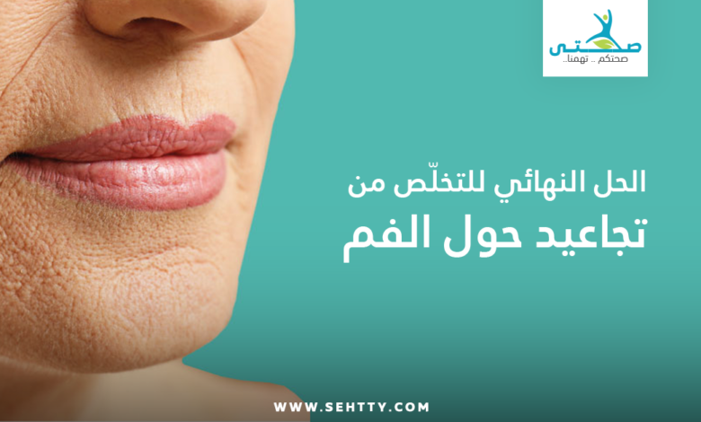 تجاعيد حول الفم