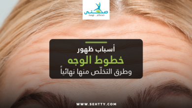 خطوط الوجه