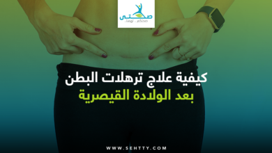 علاج ترهلات البطن بعد الولادة القيصرية