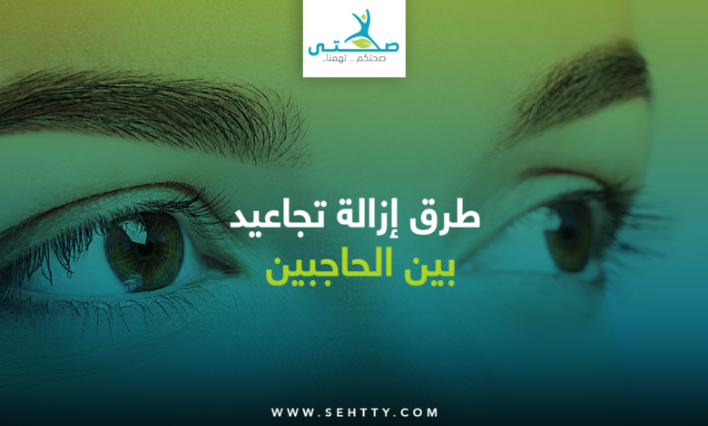 تجاعيد بين الحاجبين