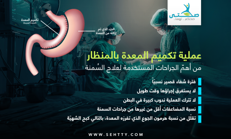 عملية تكميم المعدة بالمنظار