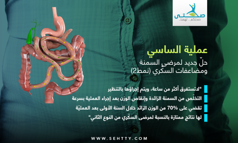 عملية الساسي