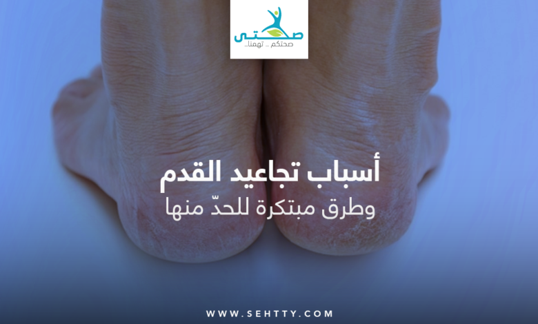 تجاعيد القدم