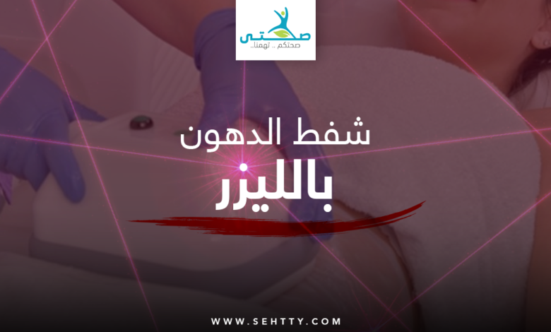 شفط الدهون بالليزر
