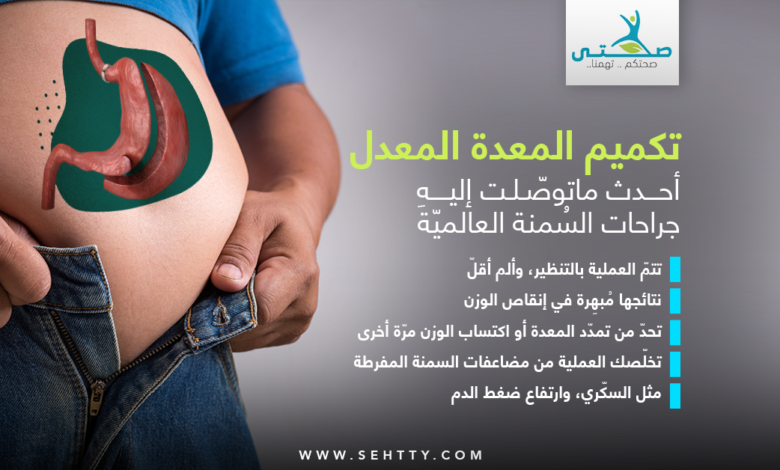 تكميم المعدة المعدل