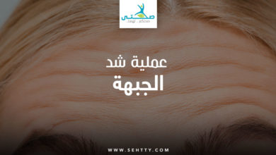 عملية شد الجبهة