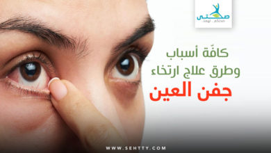 ارتخاء جفن العين