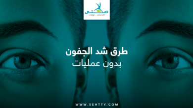 شد الجفون بدون عمليات
