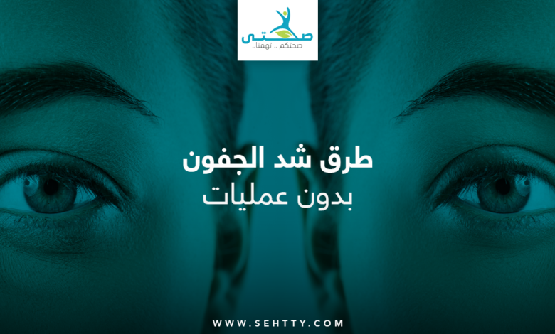شد الجفون بدون عمليات