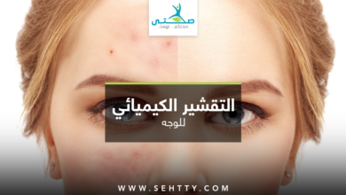 التقشير الكيميائي للوجه