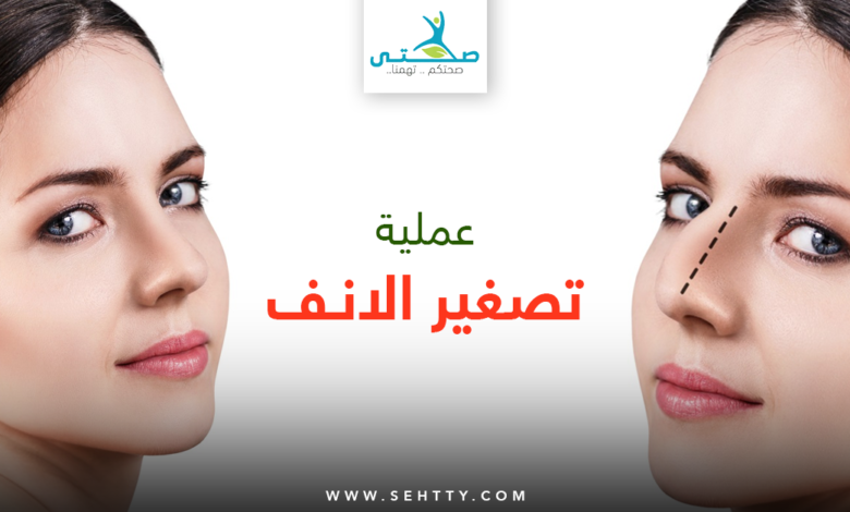عملية تصغير الانف