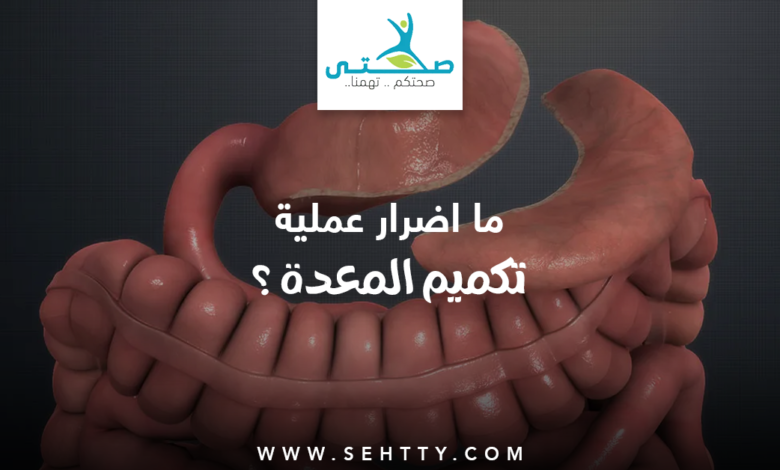اضرار عملية تكميم المعدة