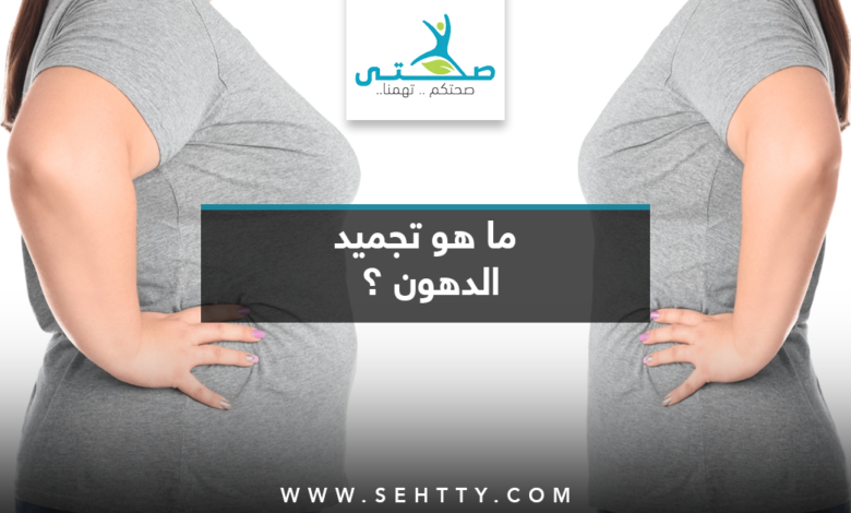 تجميد الدهون