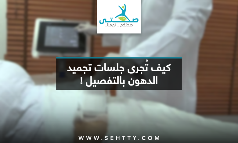 جلسات تجميد الدهون