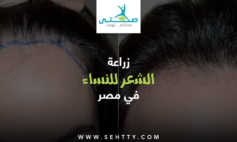 زراعة الشعر للنساء في مصر