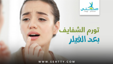 تورم الشفايف بعد الفيلر