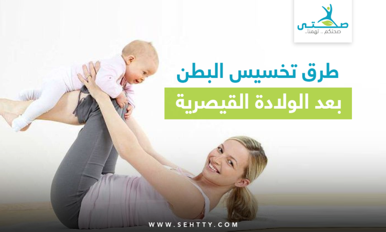 تخسيس البطن بعد الولادة القيصرية