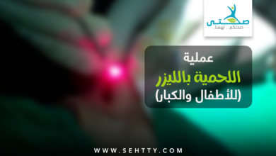 عملية اللحمية بالليزر