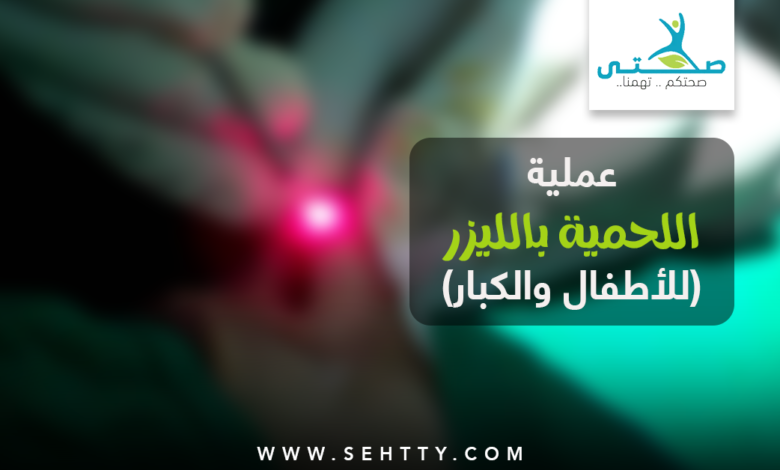 عملية اللحمية بالليزر
